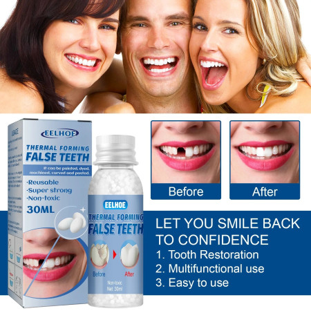 Tooth repair kit